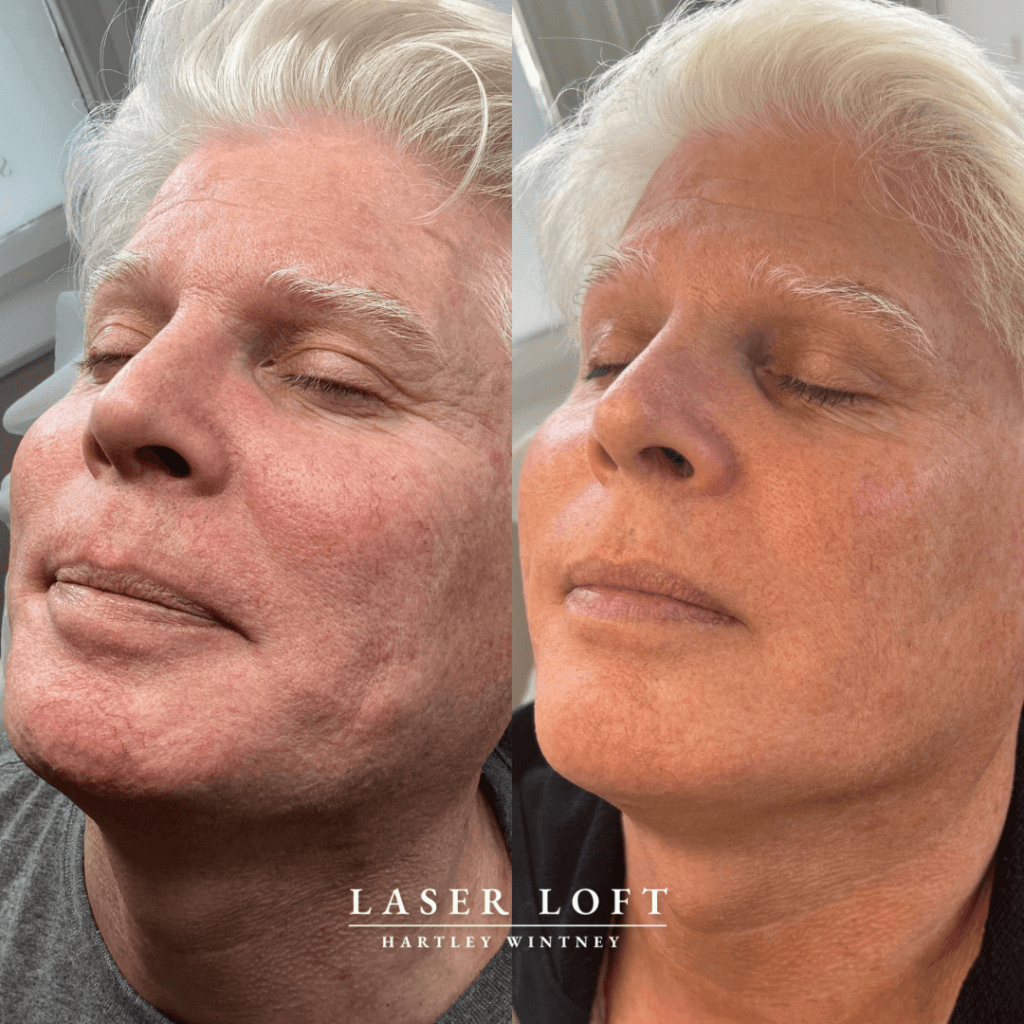 B54056AD-DC11-48A7-BB90-AD6EBA7BA79A